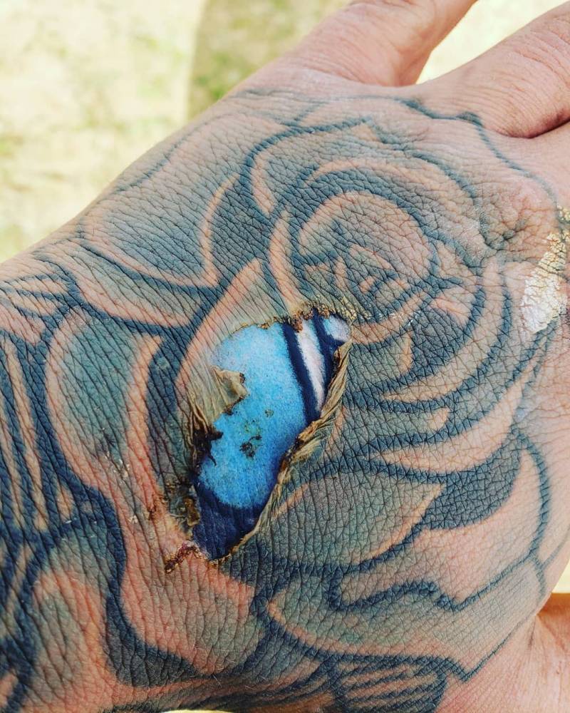 Burnt Mark Reveals Fresh Tattoo