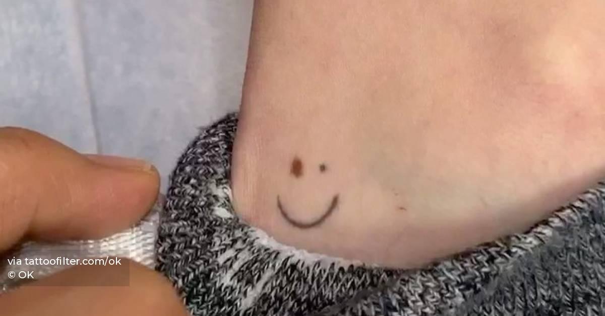 Birthmark smiley tattoo on the ankle.