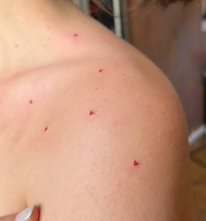 Heart freckle tattoos located on the shoulder.