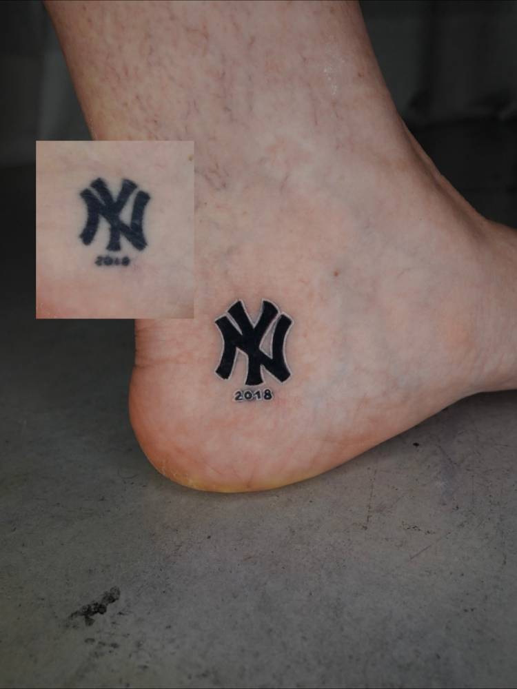 Old NY Yankees logo tattoo touch up.