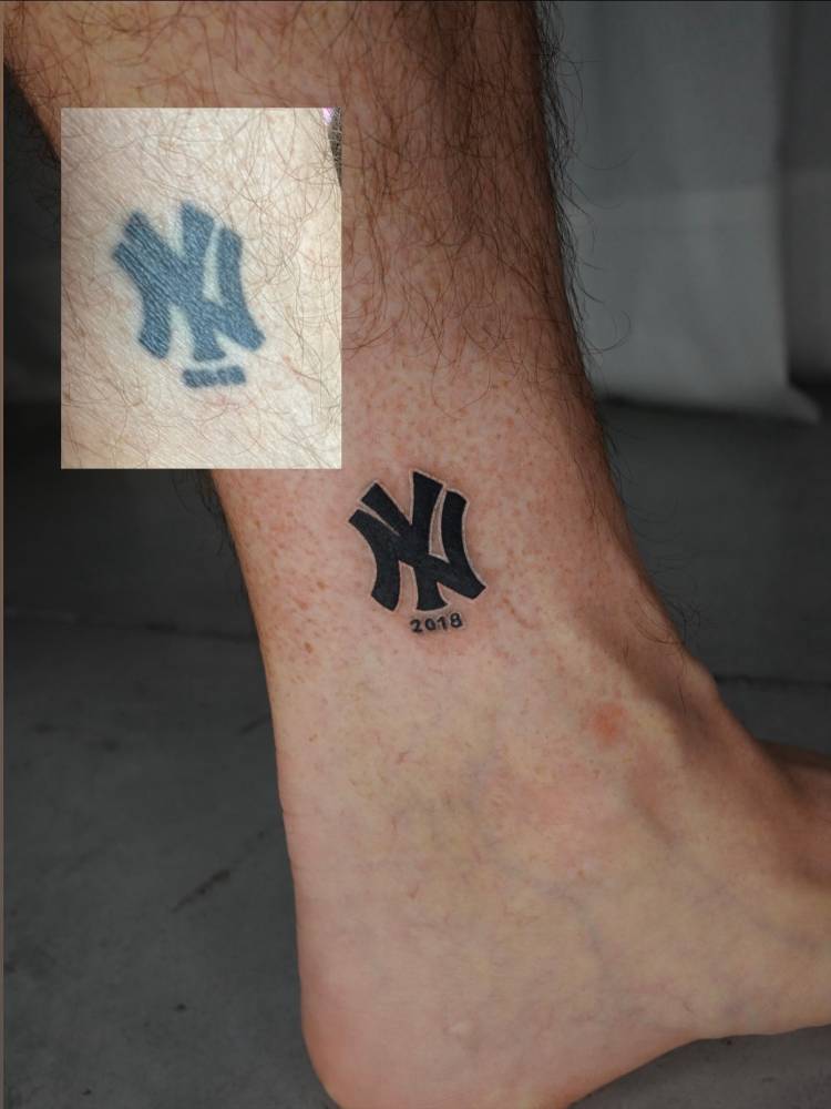 Touch up on an old NY Yankees logo tattoo.