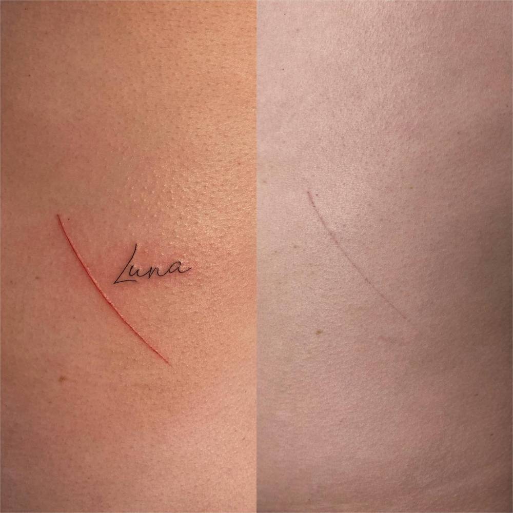 Nessa tattoo o cliente fez homenagem a sua cachorrinha que faleceu, essa marca foi feita por ela poucos dias antes da sua partida, então ele quiz deixar registrada sua última recordação.