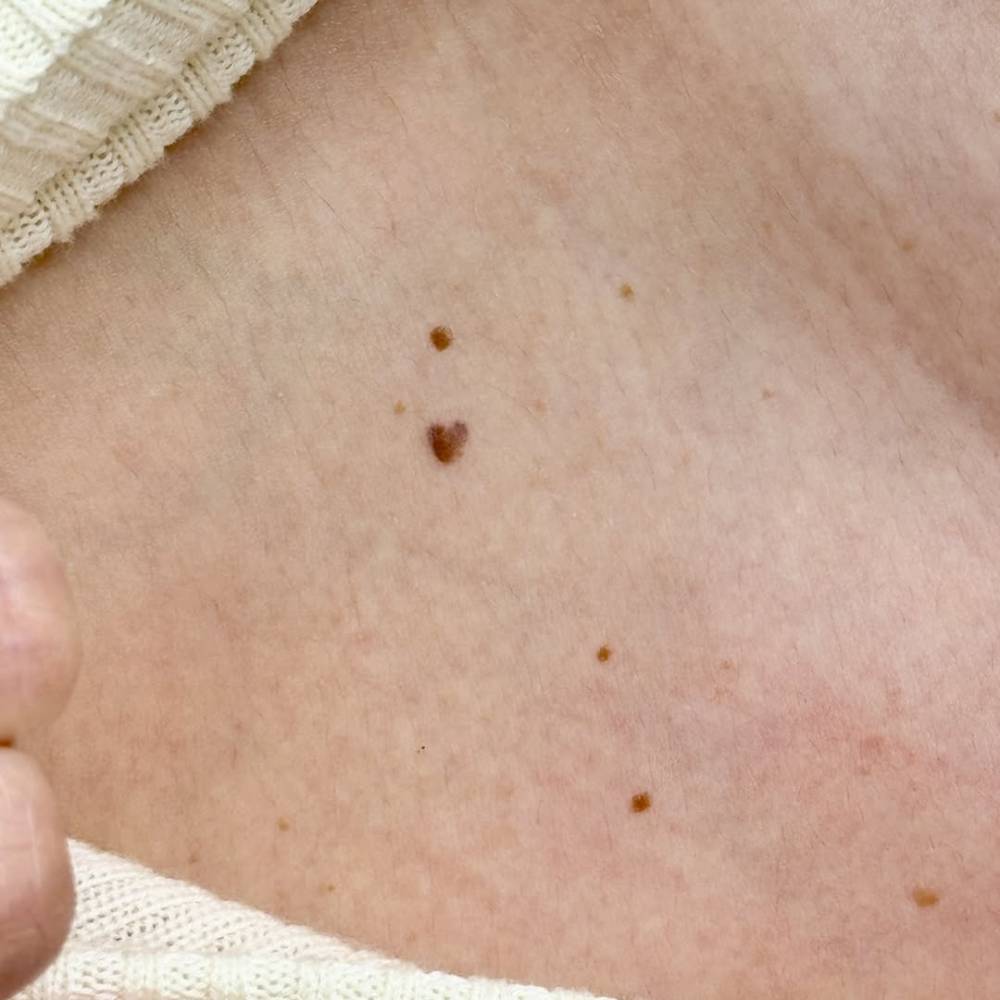 Minimalistic heart mole cover up tattoo located on the collarbone.