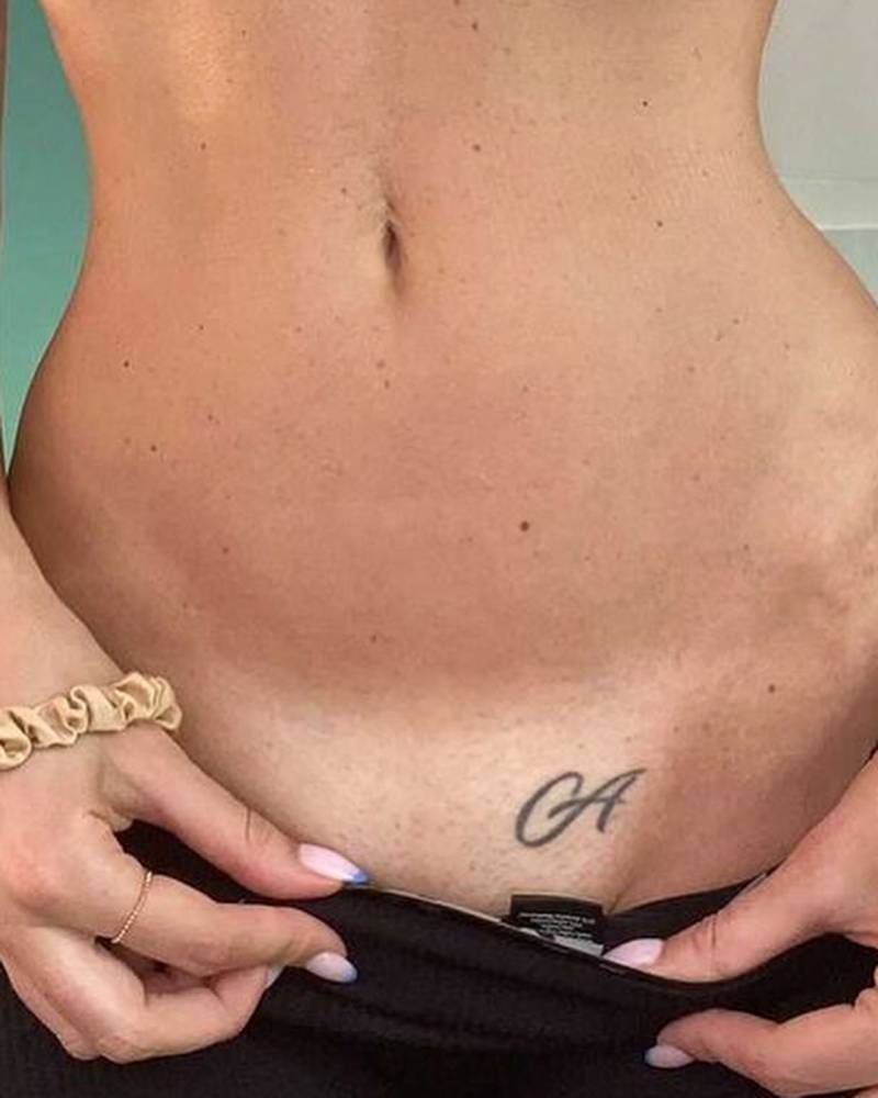 Cover up???? @Zuzanna Brzezinska