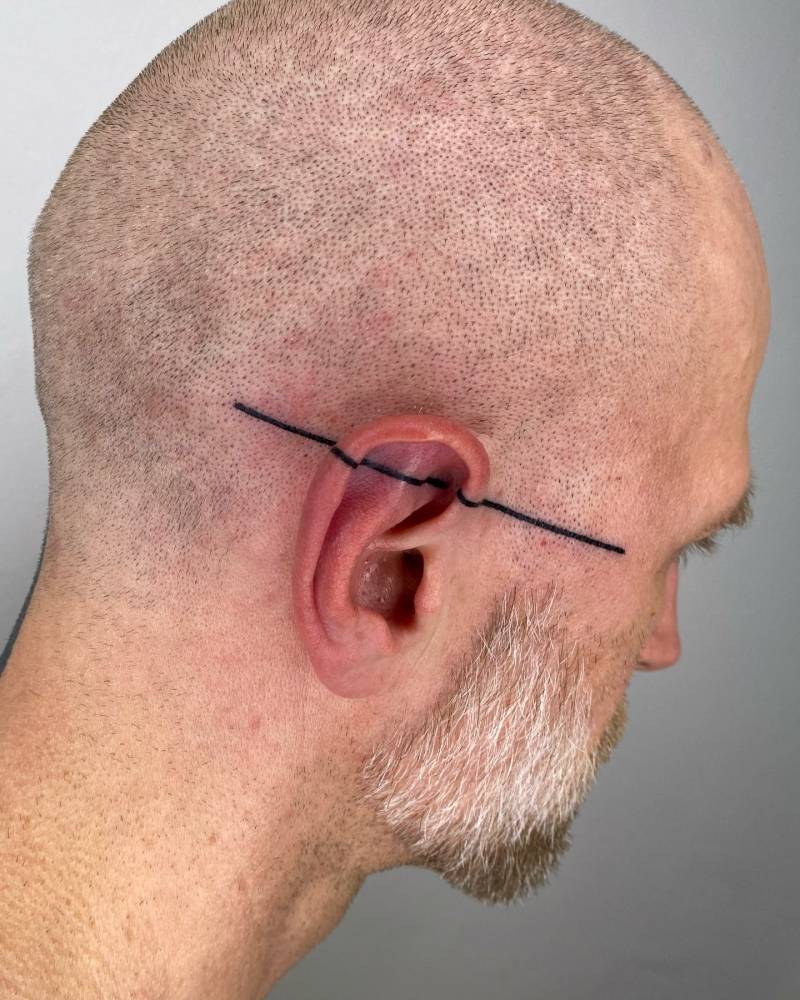 Geometric line tattoo located on the head.