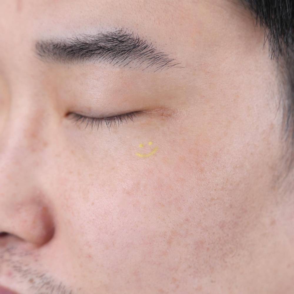 Hand poked minimalsitic smiley tattoo located on the face (1 year healed).