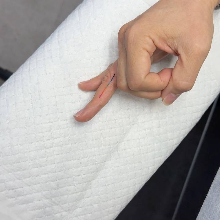 Visible spectrum tattoo placed on the finger.