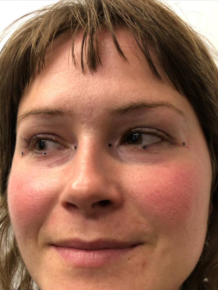 Tiny minimalistic dots tattoo located on the face.