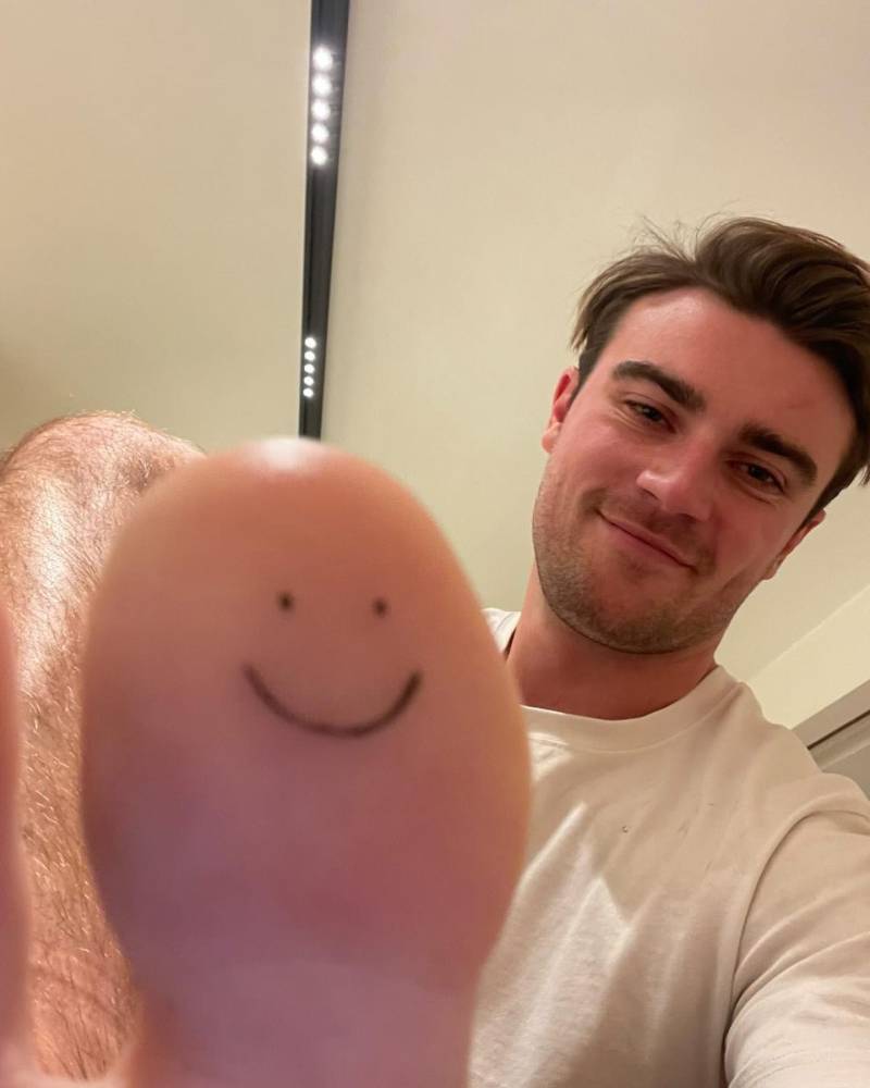 Minimalistic style smiley face tattoo located on the toe.