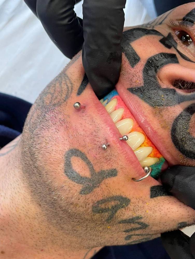 Hand poked style gum tattoo.