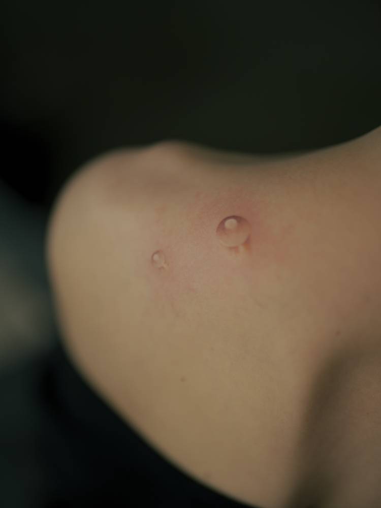 Little water drops tattooed on the shoulder blade, micro-realistic styke,